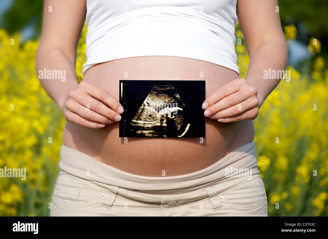 Schwangere Frau mit Ultraschall Stockfoto