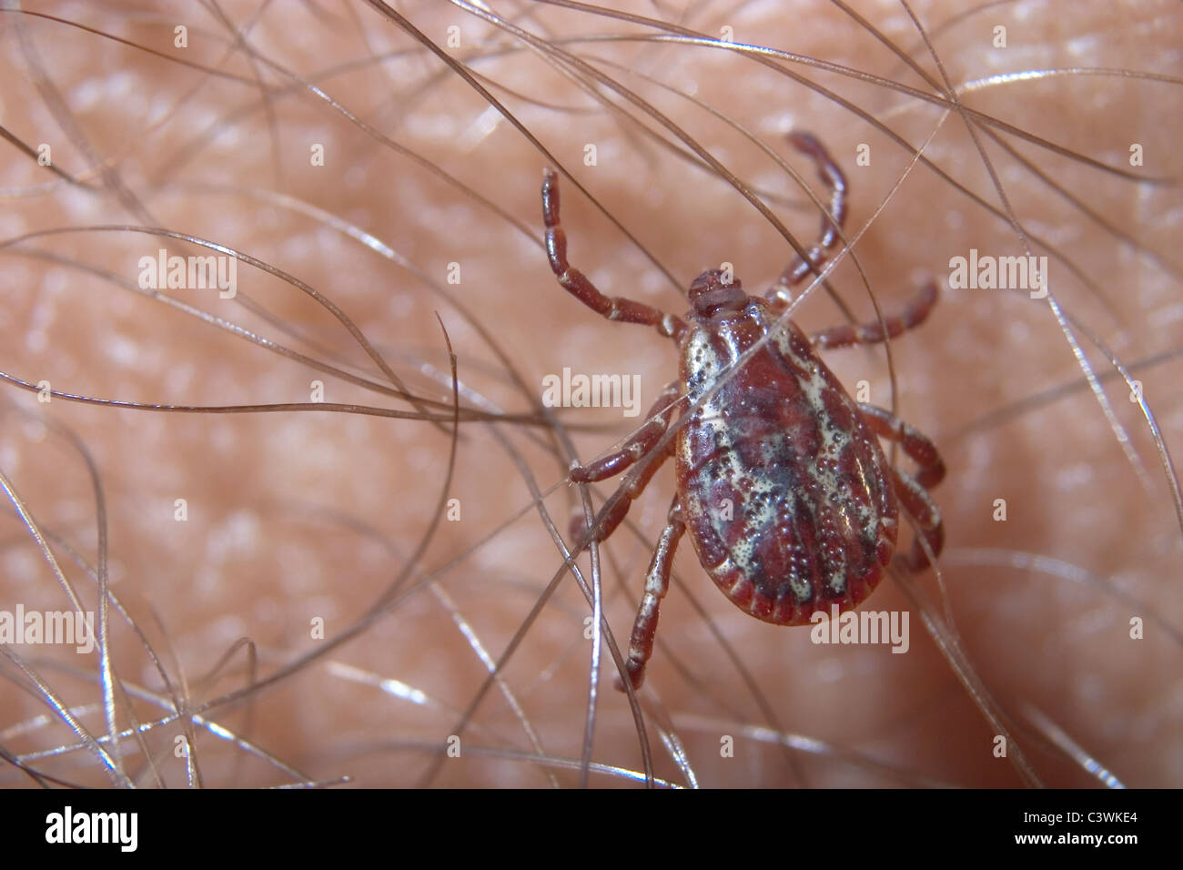 Ein American Dog Tick weiblich, auf meinem Arm, Dermacentor variabilis Stockfoto