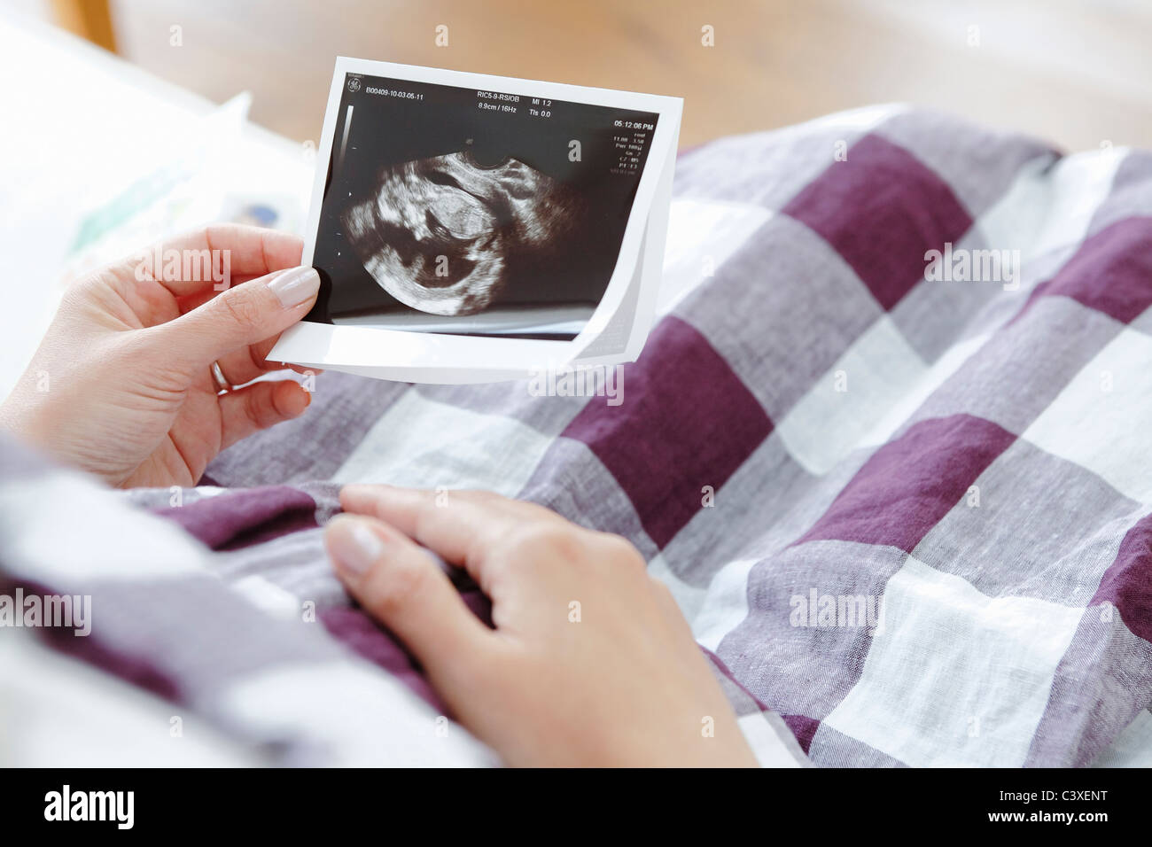 Schwangere Frau mit Ultraschall Stockfoto