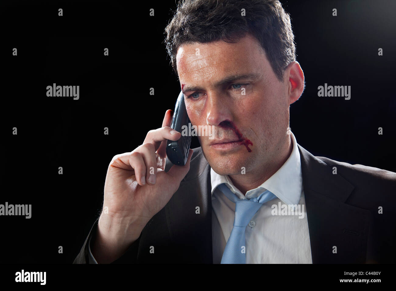 Ein Geschäftsmann mit Prellungen und eine blutige Nase mit seinem Handy  Stockfotografie - Alamy