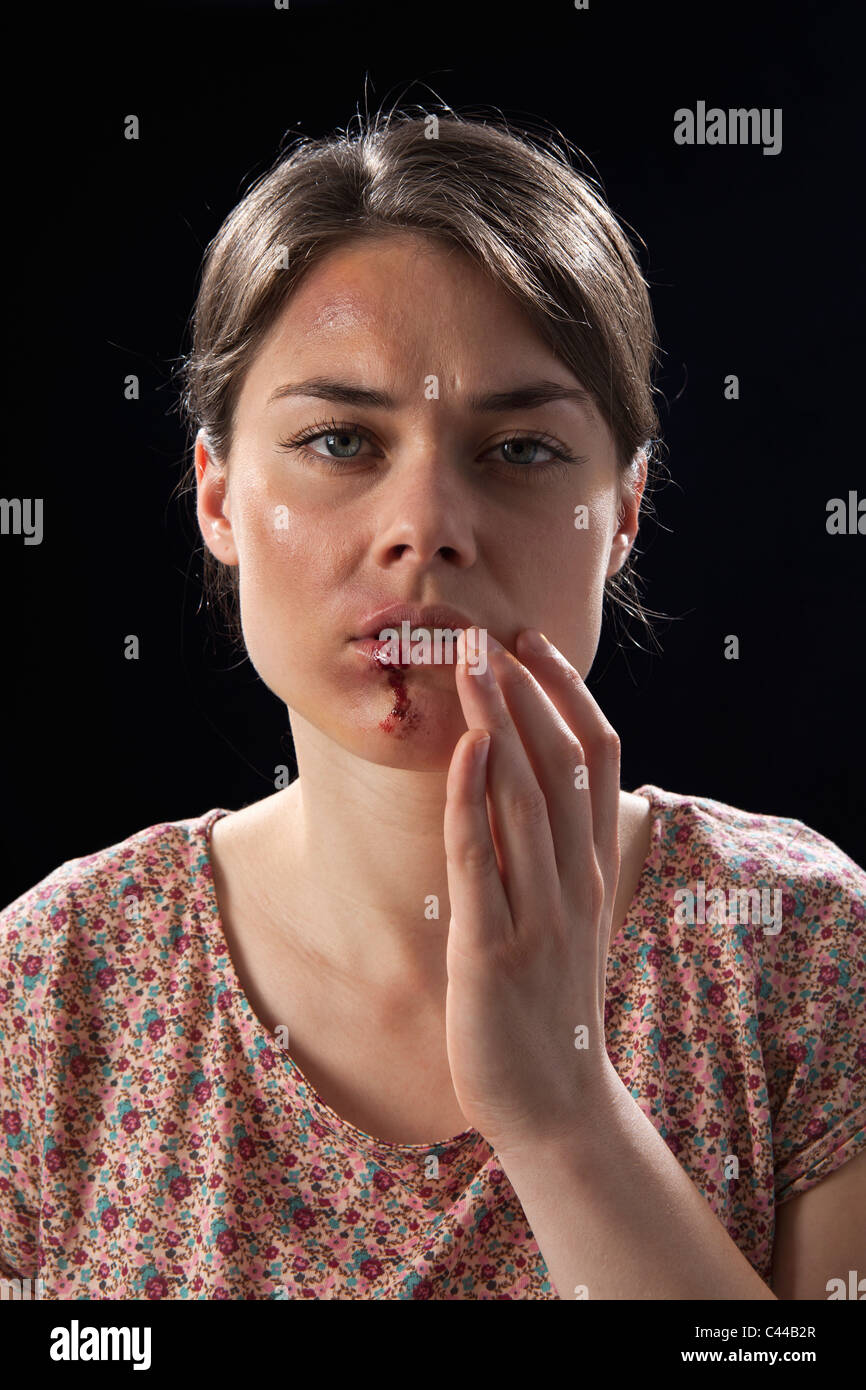 Eine Frau mit blauen Flecken und blutigen Lippe Stockfoto