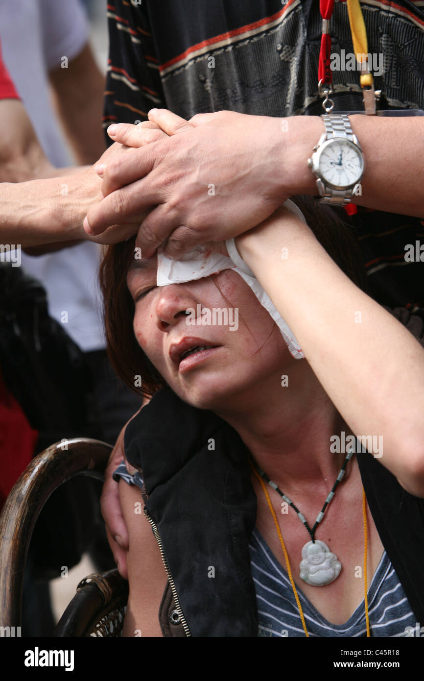 Frau Blutungen und Schmerzen in einem Straße Protest, Demonstration, Macau Stockfoto