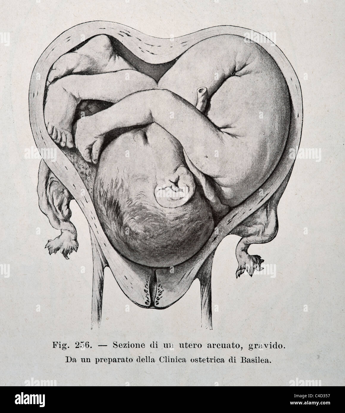 Illustration des menschlichen Fötus copyright 1905 Stockfotografie Alamy