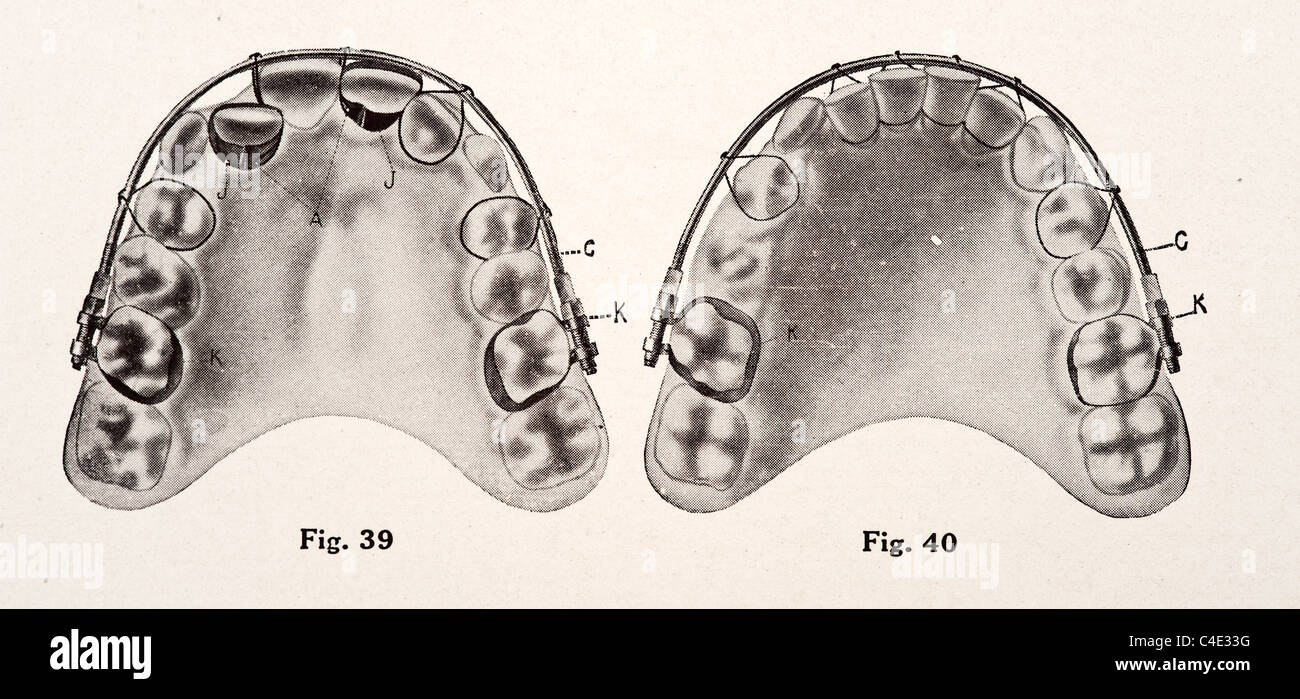 Illustration des menschlichen Zähnen copyright 1911 Stockfoto