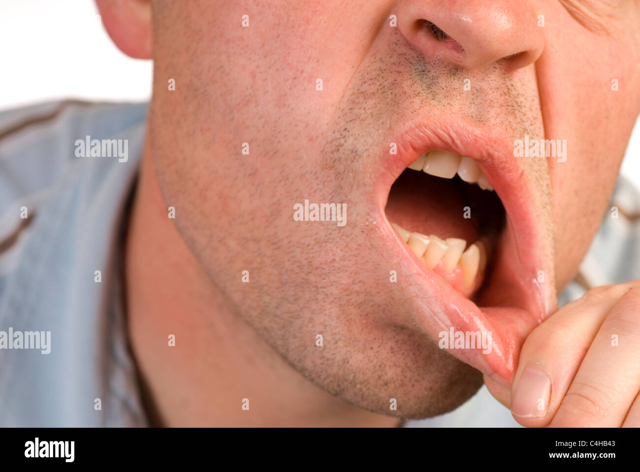 Männlichen Lippe ziehen und seine Zähne zeigen Stockfoto