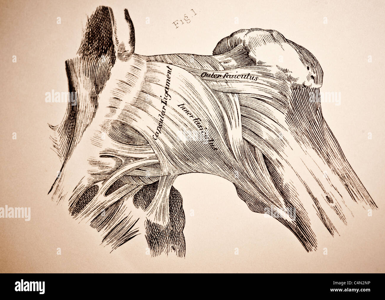 Illustration des Hüftgelenks ca. 1882 Stockfoto
