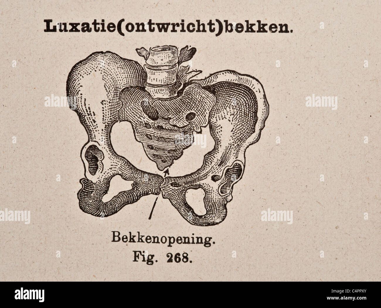 Antike medizinische Illustration der Becken-Knochen Stockfoto