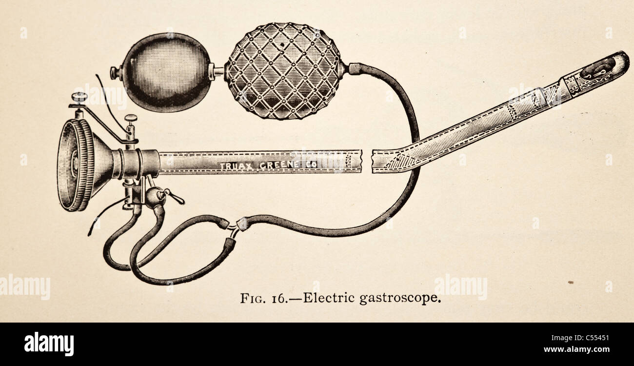 Gastrokamera Fotos und Bildmaterial in hoher Auflösung Alamy