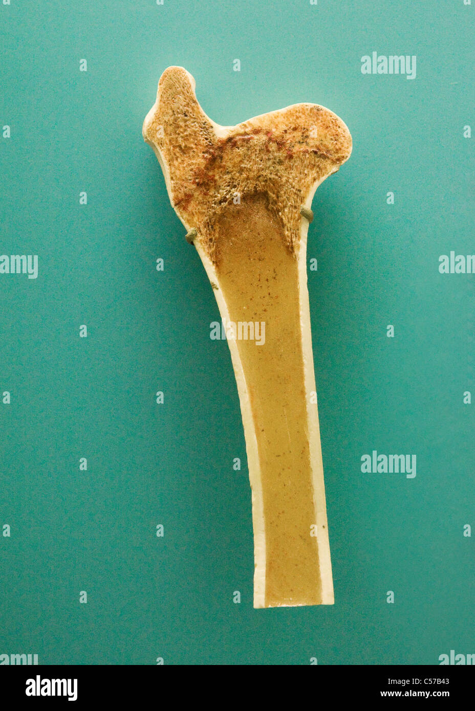 Querschnitt des menschlichen Röhrenknochen zeigt Trabekel Knochengewebe Stockfoto