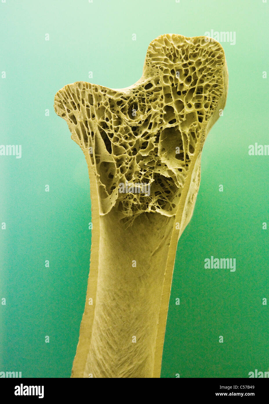 Querschnitt des menschlichen Röhrenknochen zeigt Trabekel Knochengewebe Stockfoto