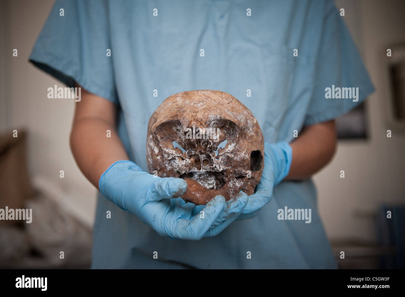Anthropologe Prüfung eines menschlichen Schädels in der Leichenhalle Anlage der ICMP-Kommission der vermissten in Stadt Tuzla, Bosnien. Stockfoto