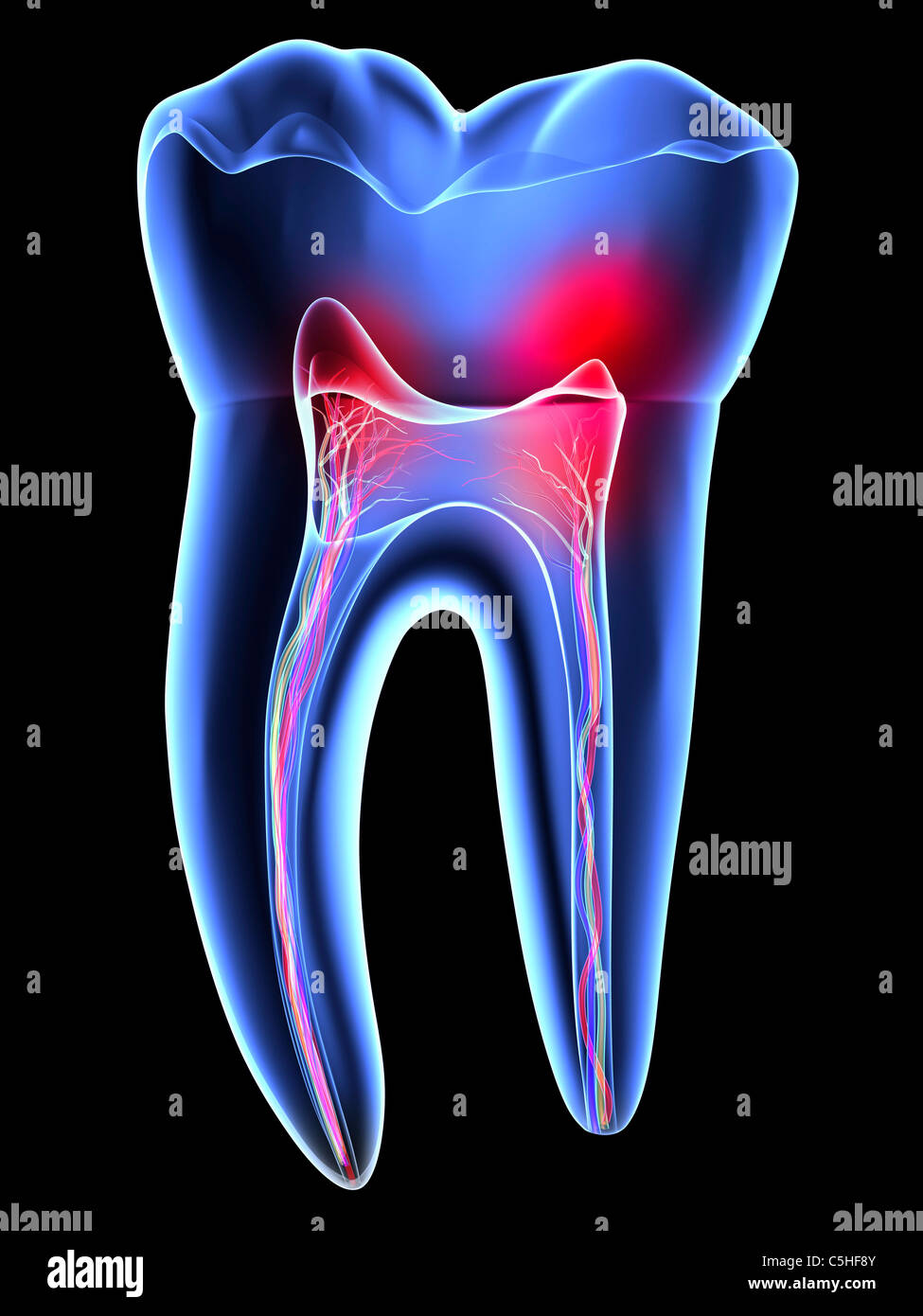 Zahnschmerzen, Zahnschmerzen Stockfoto