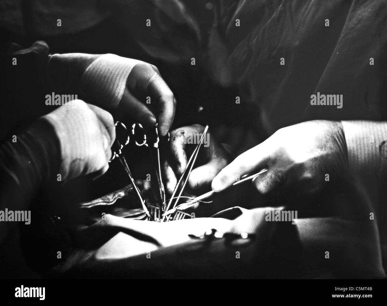 Chirurgen, beginnen sie auf einen verletzten Mann zu Royal Sussex County Hospital RSCH 1990 gab s zu bedienen Stockfoto