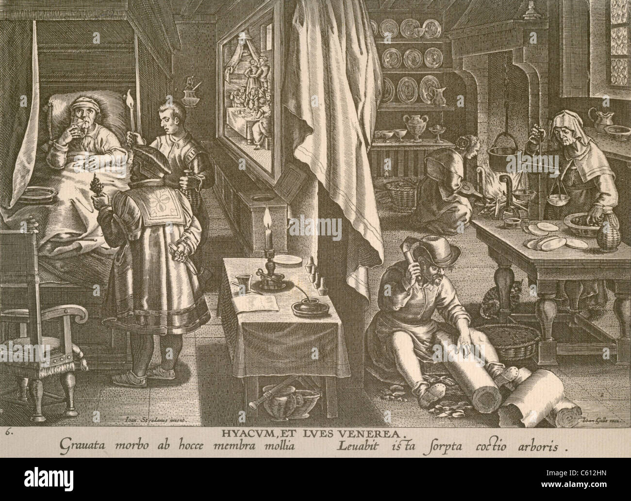 Eine Multi-Szene Gravur zeigt die Behandlung eines europäischen Syphilis-Patienten, trinkt Guayaco, eine Medizin, die aus dem Holz des Baumes Guaiacum (wird vorbereitet und gekocht auf rechten Seite) gemacht. Mitte links ist eine Bordell-Szene, die die Quelle der sexuell übertragbaren Krankheit war. Ca. 1570. Stockfoto