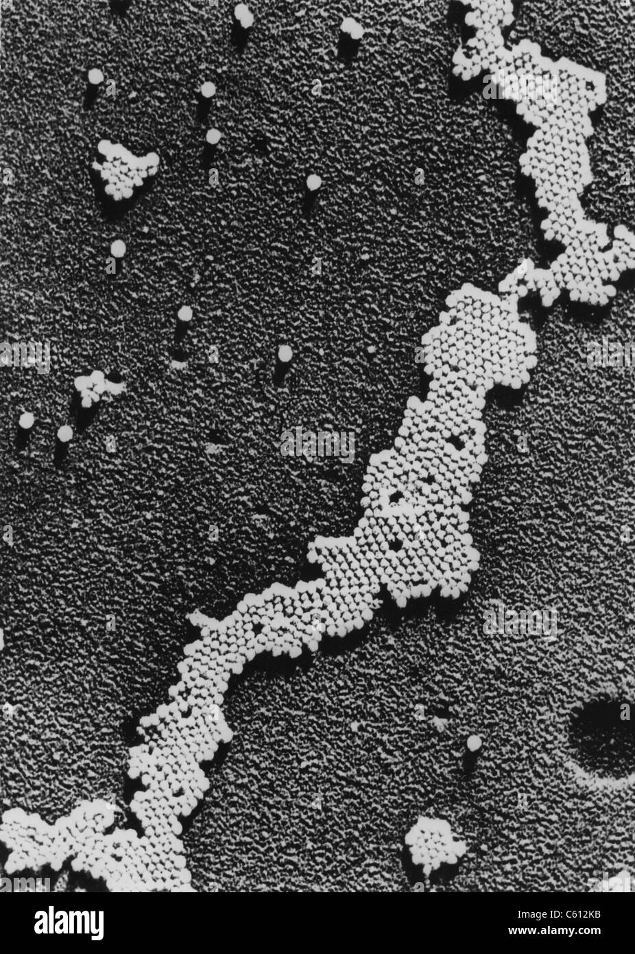 Kinderlähmung (Poliomyelitis) Virus, die Ursache der Kinderlähmung, wurde 1908 von Karl Landsteiner entdeckt. Die Impfung gegen Kinderlähmung wurde zwischen 1948 und 1953, konnten die Forscher in der Lage, große Mengen des Virus zu wachsen, als Jonas Salk entwickelt einen sicheren getötet-Virus-Impfstoff entwickelt. Stockfoto