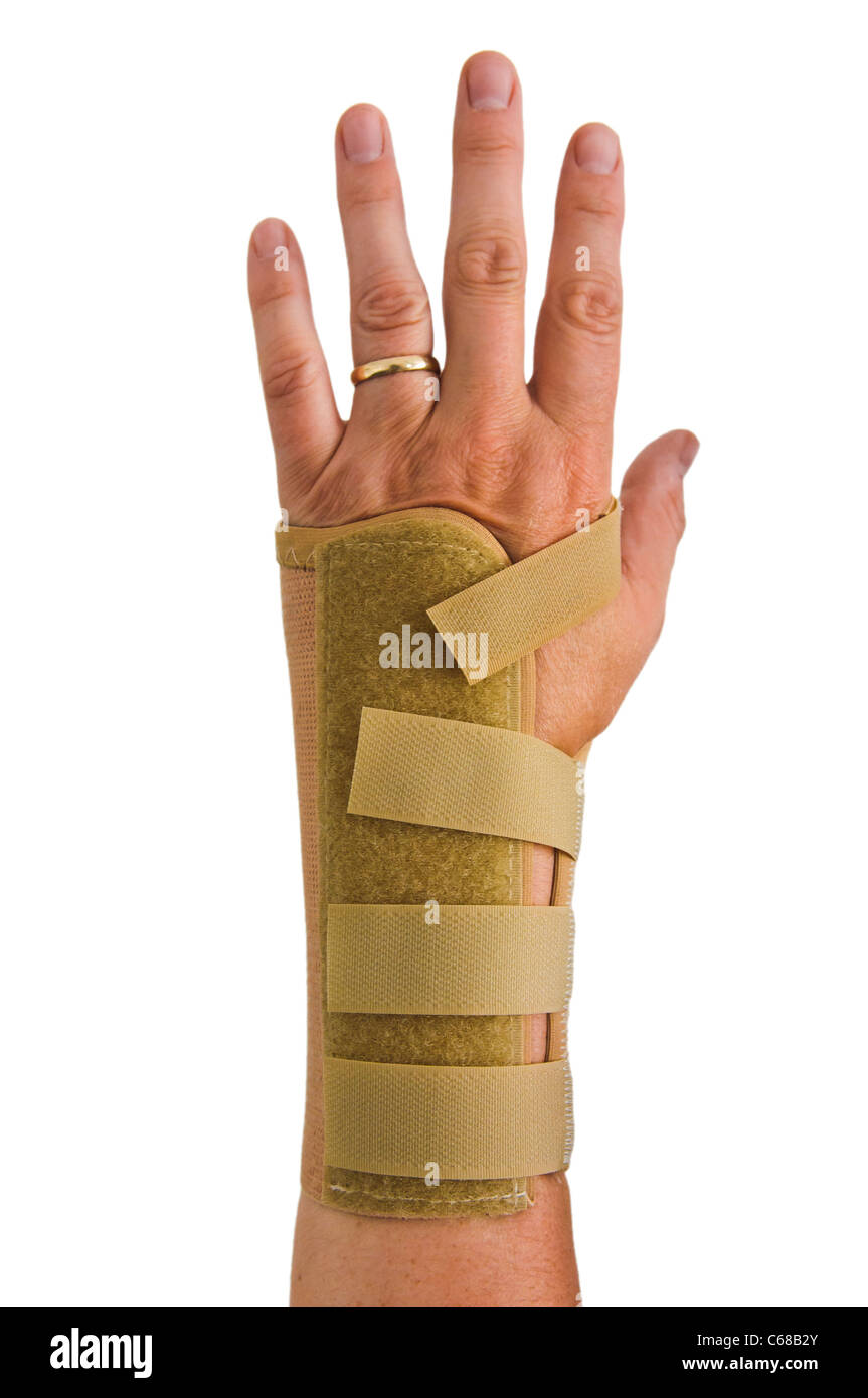 Mann mit Hand Schiene Handgelenk Schmerzen verursacht durch Karpaltunnelsyndrom zu reduzieren Stockfoto