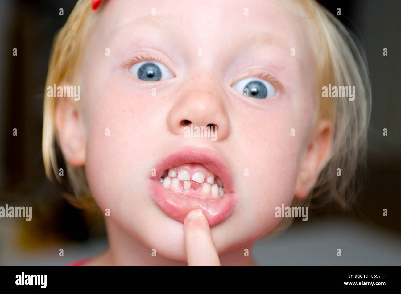 Junge Mädchen mit ersten Zahn fehlt Stockfoto