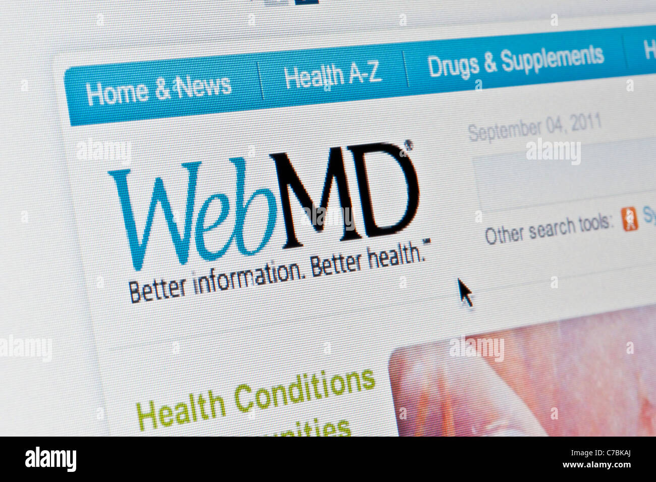 Nahaufnahme von WebMD Logo wie auf ihrer Website zu sehen. (Nur zur redaktionellen Verwendung: print, TV, e-Book und redaktionelle Webseite). Stockfoto