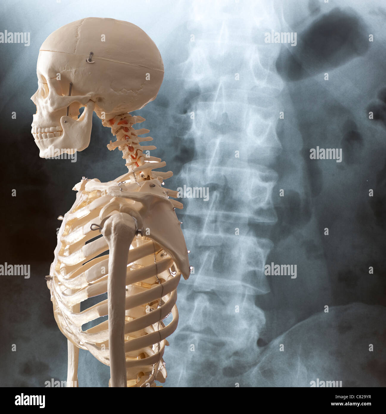 Konzept-Bild Skelett und Wirbelsäule Röntgenhintergrund Stockfoto
