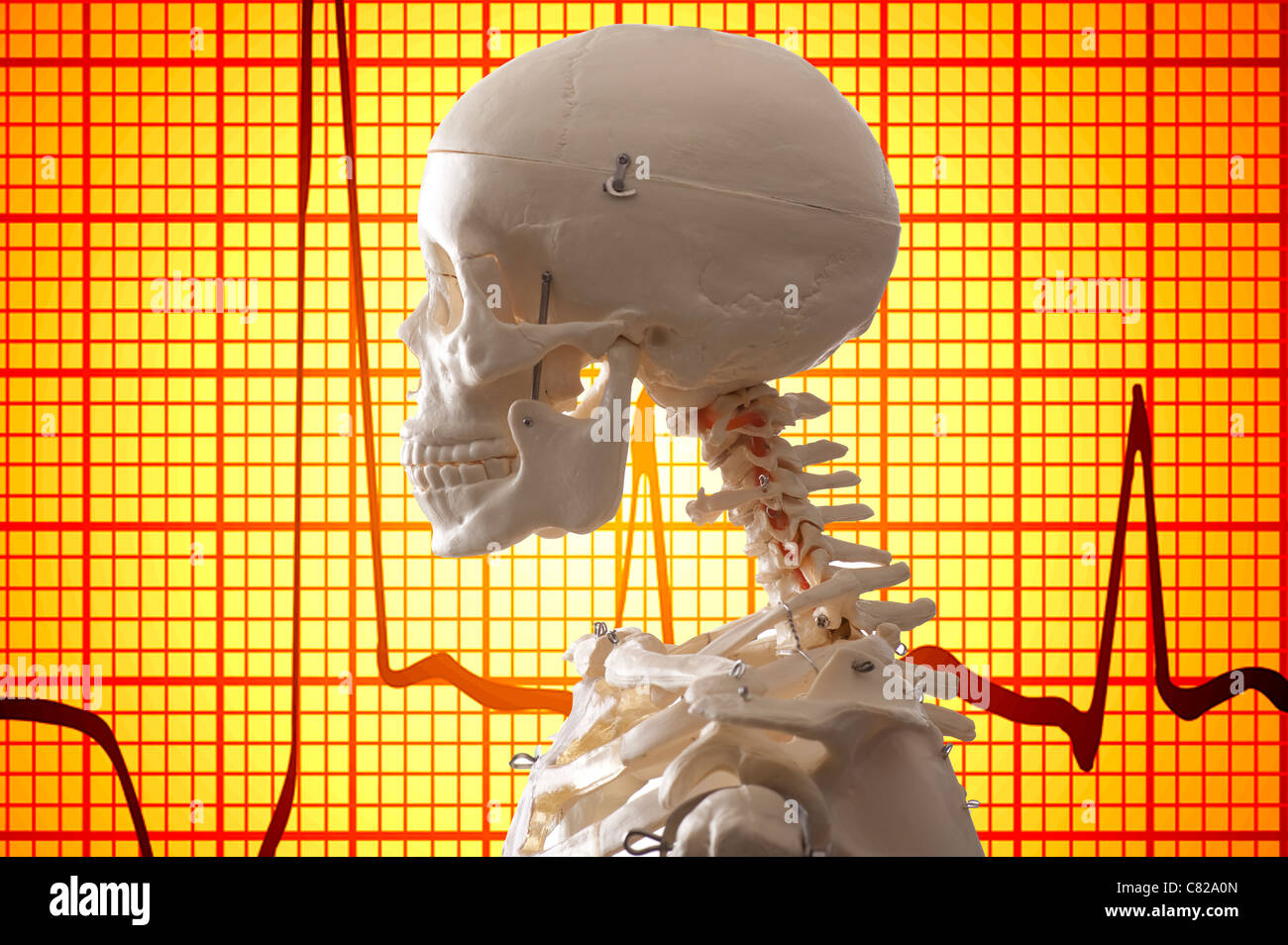 Konzept-Bild menschlichen Skeletts und EKG-Hintergrund Stockfoto