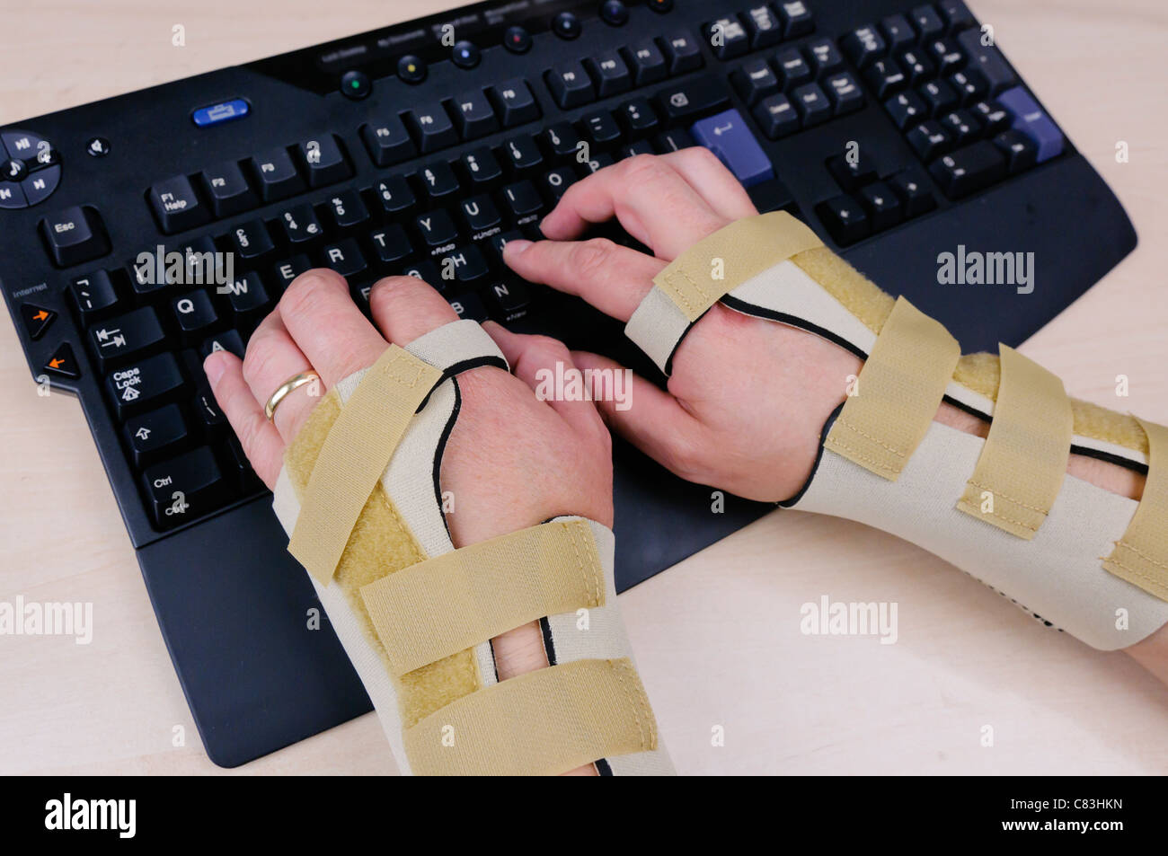 Mann mit Karpaltunnelsyndrom und tragen Handgelenksschienen mit einer  Computertastatur Stockfotografie - Alamy