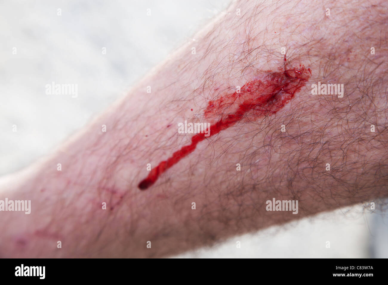 Blut auf eine männliche Bein Haut. Verletzungen, Unfall Stockfoto