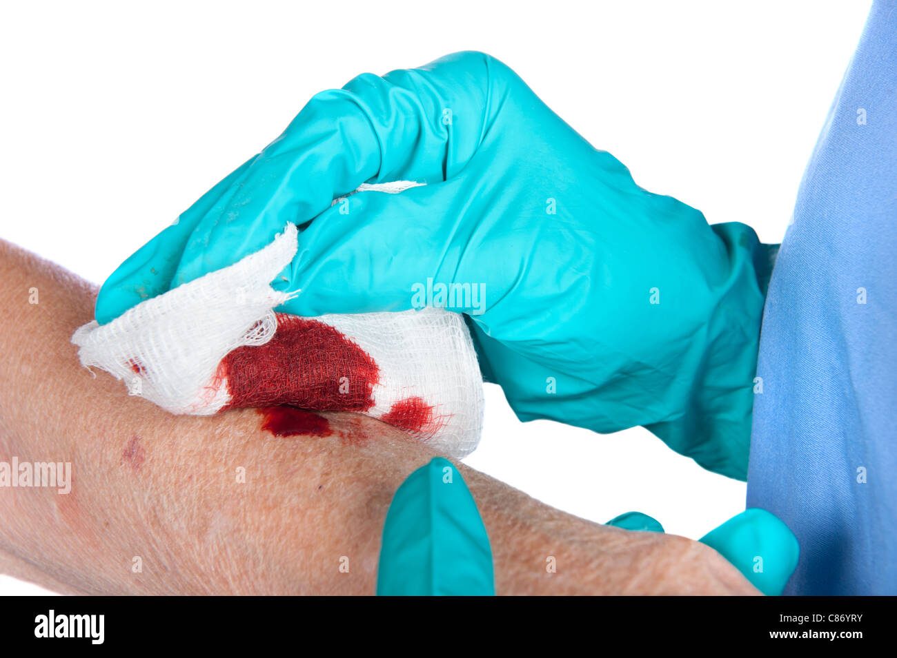 Eine Krankenschwester neigt dazu, eine blutige Wunde auf eine ältere Frau Arm Stockfoto