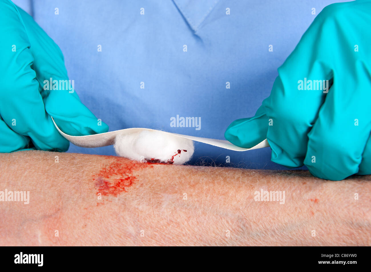 Eine Krankenschwester neigt dazu, eine blutige Wunde auf eine ältere Frau Arm Stockfoto