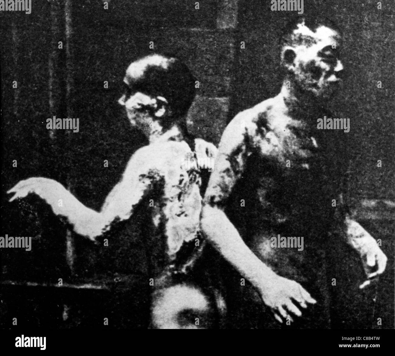 zwei brennen nach der atomaren Explosion in Hiroshima, 1945 Stockfoto