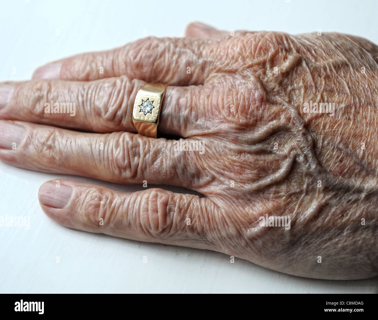 Handhautvene Stockfotos Und Bilder Kaufen Alamy