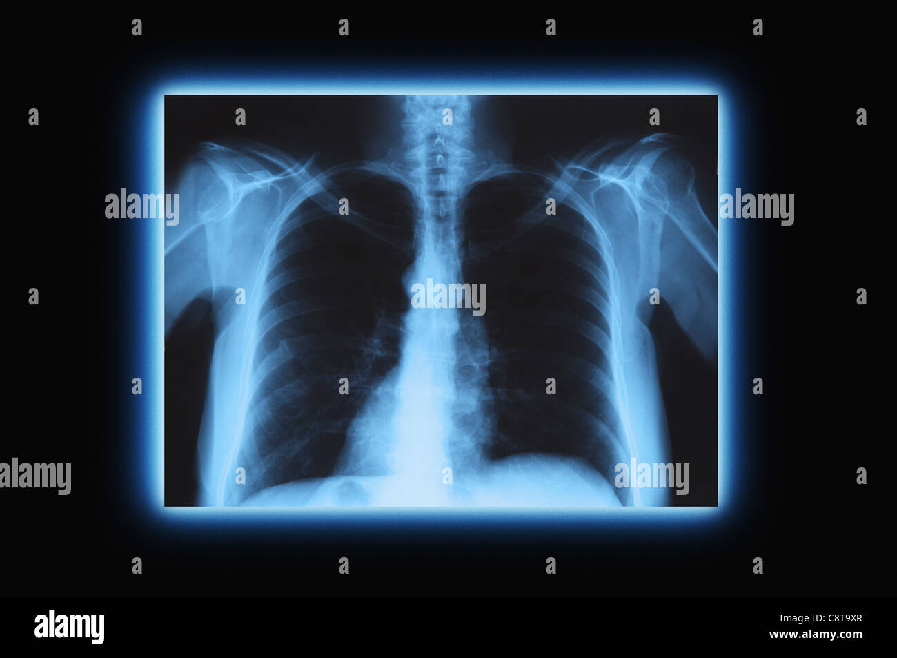 Studioaufnahme von Röntgen-Thorax Stockfoto