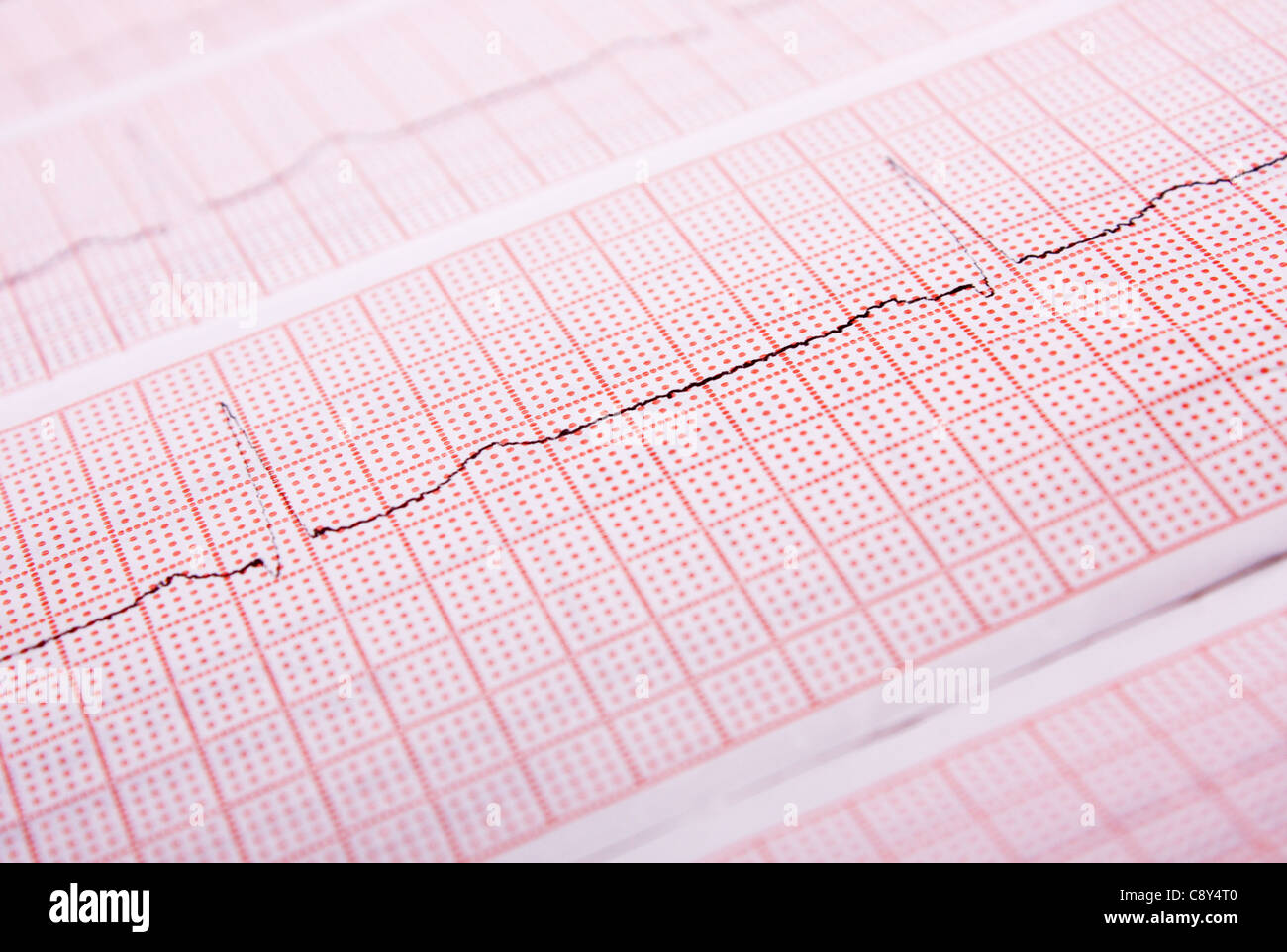 Nahaufnahme eines Herzfrequenz-Monitor-Ausdrucks Stockfoto