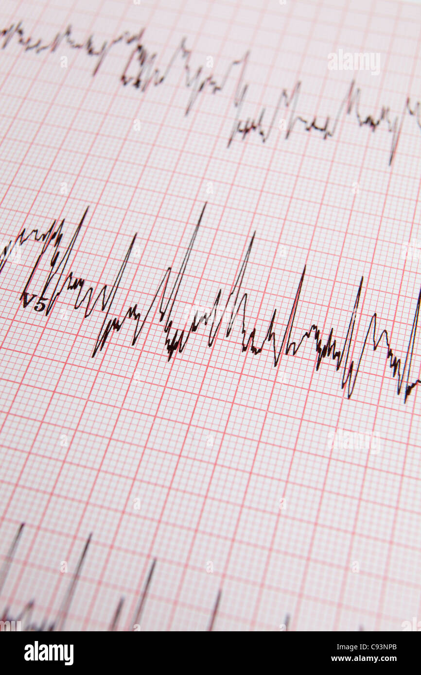 ECG ausdrucken Stockfoto