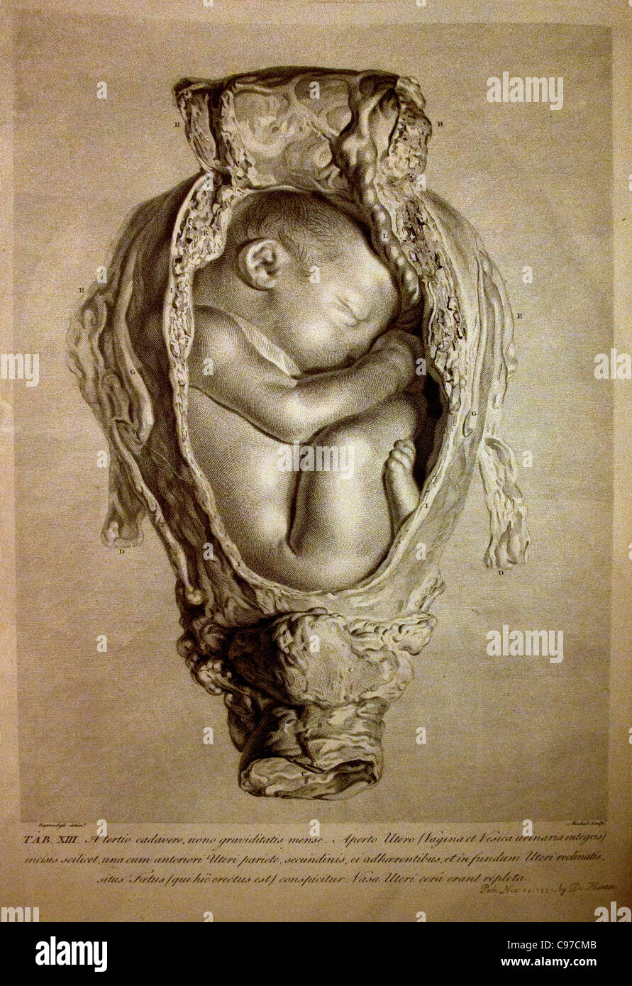 William Hunter schottischer Anatom und Arzt die Anatomie der menschlichen trächtigen Uterus ausgestellt in Zahlen Stockfoto