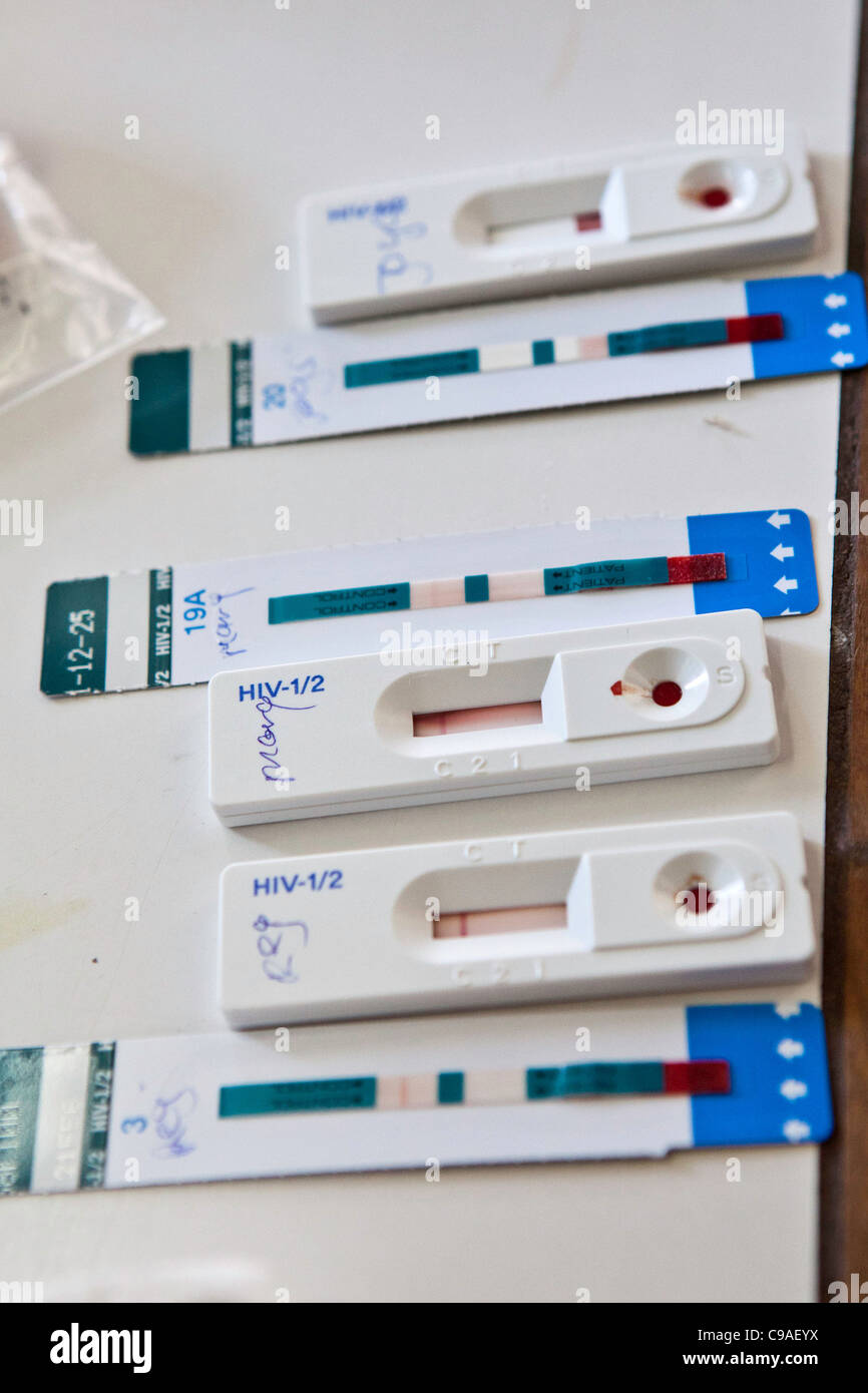 HIV-Bluttests wird in der freiwilligen Prüfung Klinik an der Wema Centre in Mombasa, Kenia durchgeführt. Stockfoto