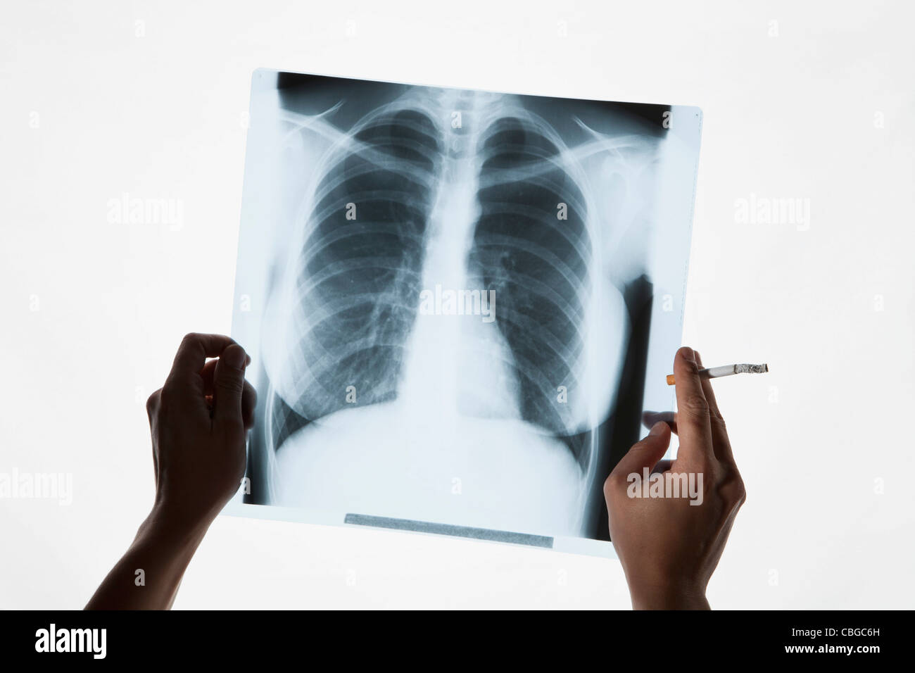 Hände halten eine Röntgenaufnahme und eine Zigarette, close-up Stockfoto