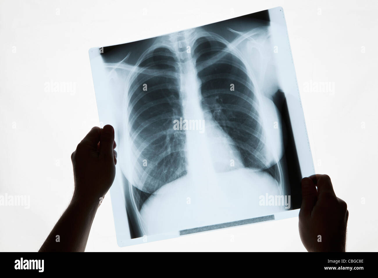 Hände halten ein Röntgen-Thorax, close-up Stockfoto