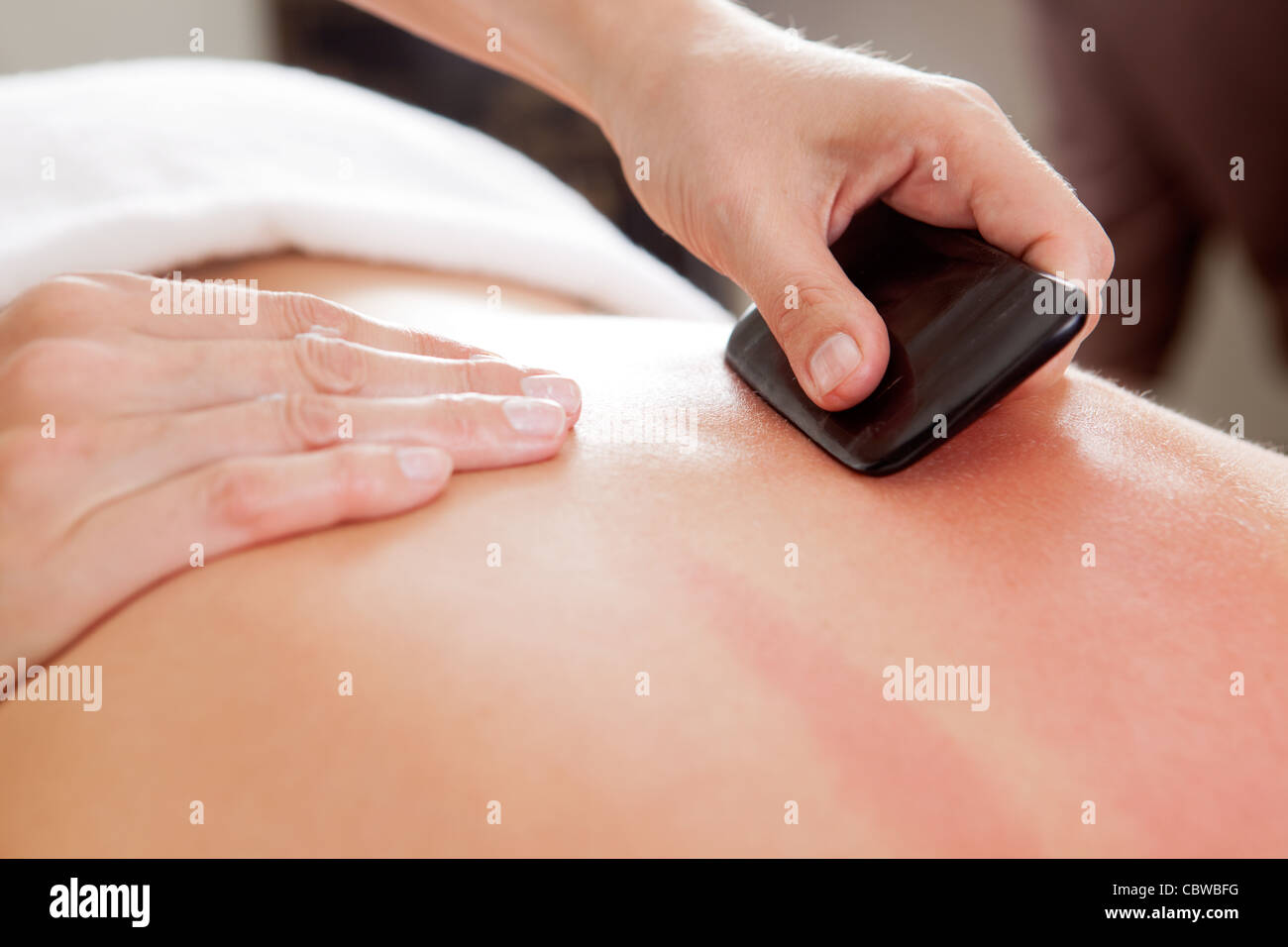 Große Knochen Etikettenschaber verwendet wird eine Akupunkturbehandlung Guasha bereuen Stockfoto