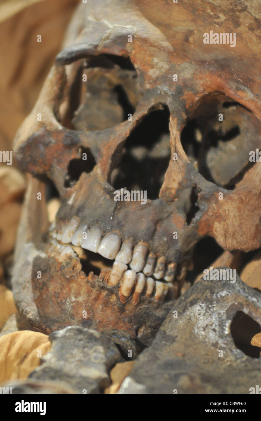 Die Mumie von Smenkhkere (BC 1374 XVIII Dynastie) im ägyptischen Museum, ägyptische und deutsche Experten geprüft wird. Stockfoto