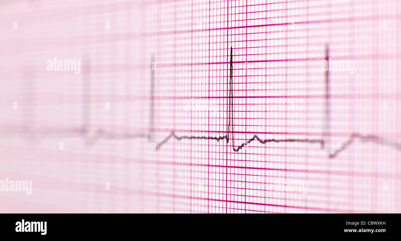 Ekg Ausdruck Stockfoto