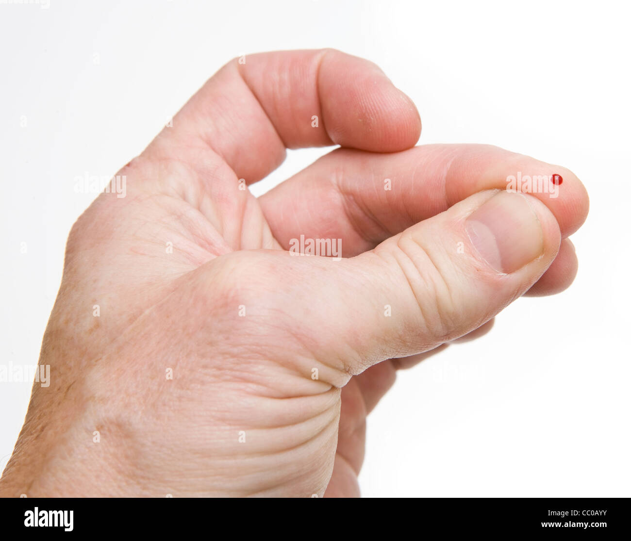 Tropfen Blut am Finger für einen Blutzuckertest Stockfoto