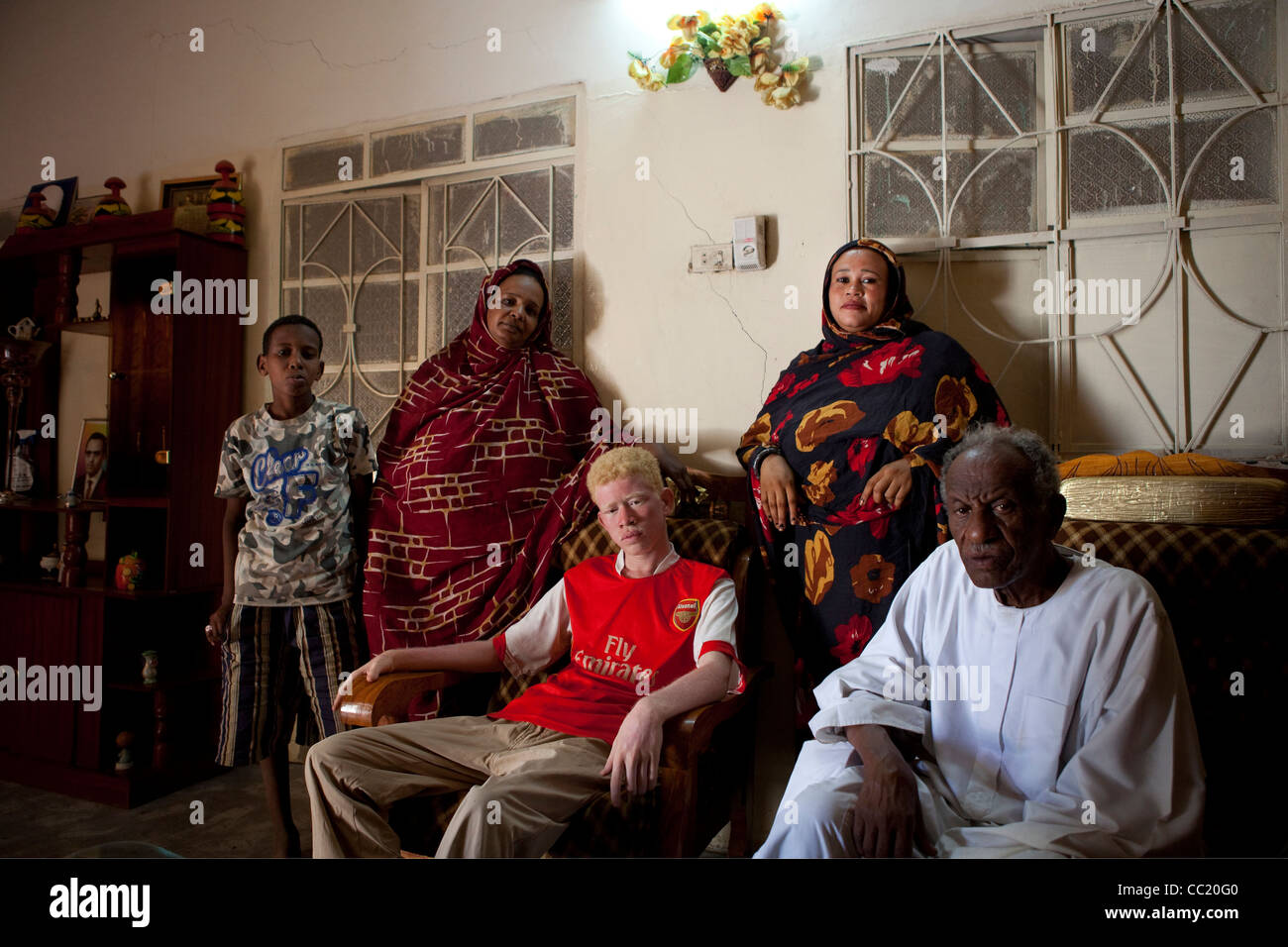 African Albino Stockfotos und bilder Kaufen Alamy