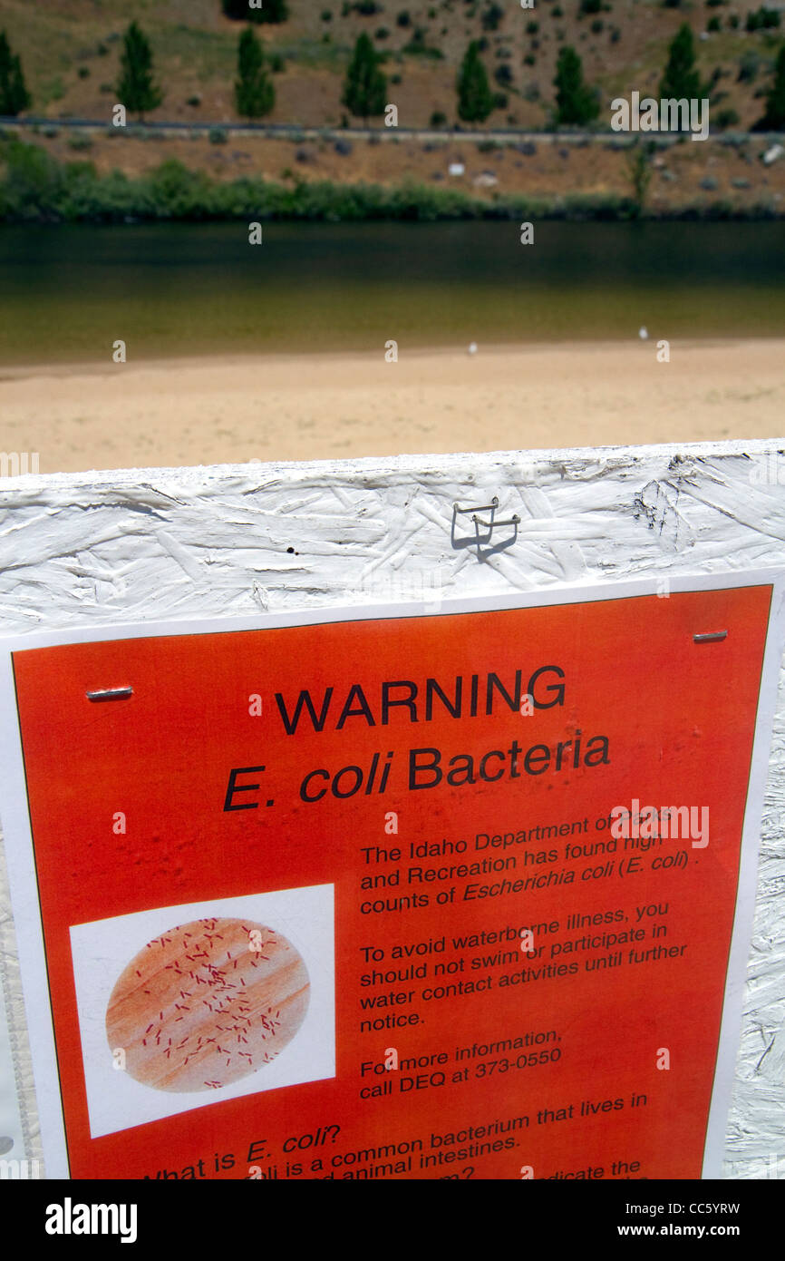Ein Schild Warnung von E. Coli-Bakterien in der Sandy Point Schwimmen Wasser im Entdeckerpark unter Lucky Peak Dam, Idaho, USA. Stockfoto