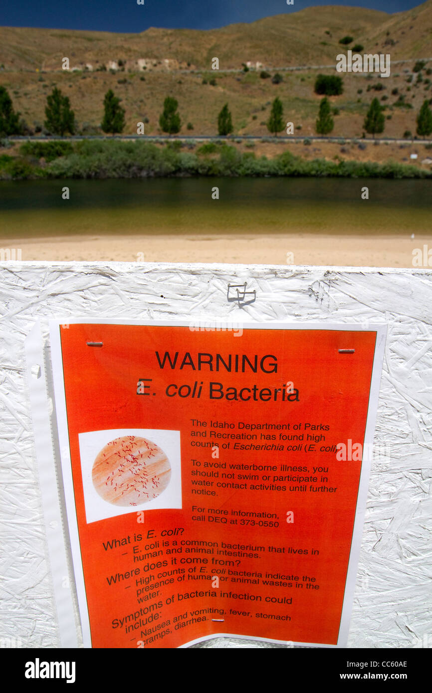 Ein Schild Warnung von E. Coli-Bakterien in der Sandy Point Schwimmen Wasser im Entdeckerpark unter Lucky Peak Dam, Idaho, USA. Stockfoto
