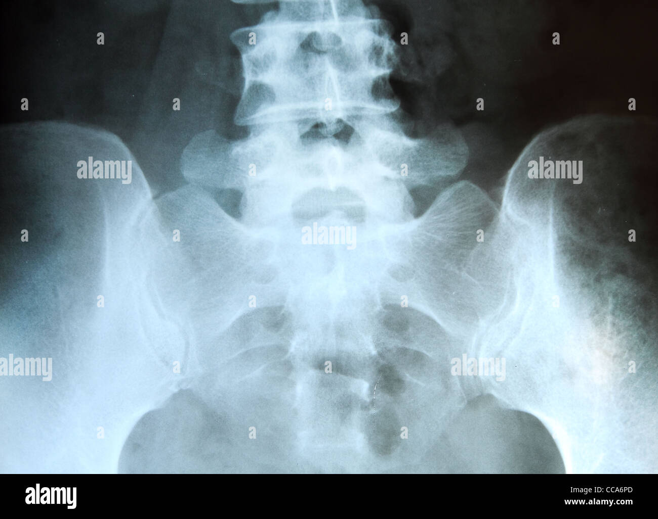 Anatomie des menschlichen beckens -Fotos und -Bildmaterial in hoher ...