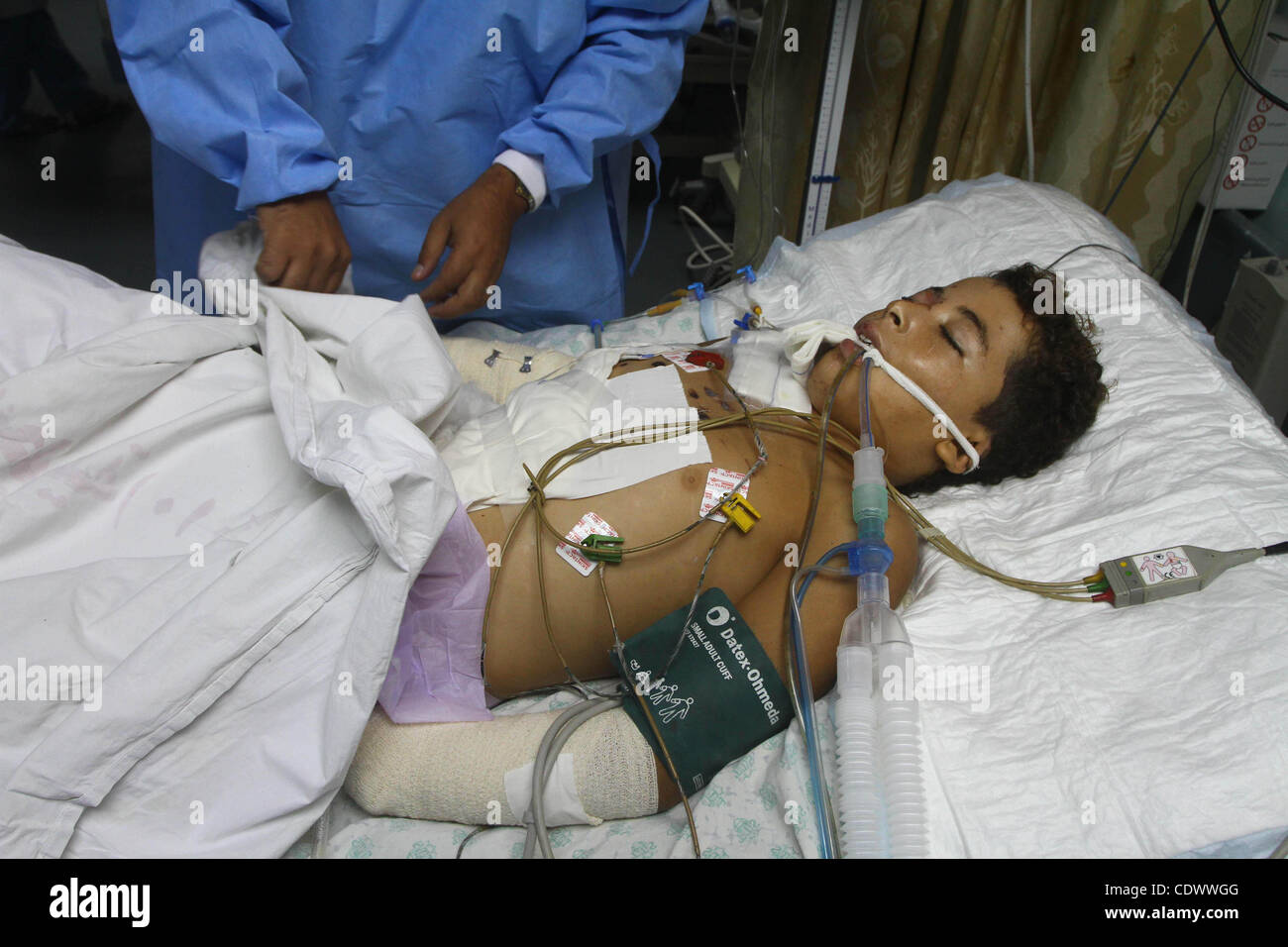 Ebrahim Al-Zaza, 15 Jahre alten Verwundeten palästinensischen Jungen, erhält eine Behandlung innerhalb der Intensivstation in al-Shefa Krankenhaus in Gaza-Stadt, 21. August 2011. Bisher 15 Palästinenser, darunter drei Kinder wurden getötet und etwa 40 verletzt in die neuesten andauernde israelische Gewalt im Gaza-Streifen. Foto Stockfoto