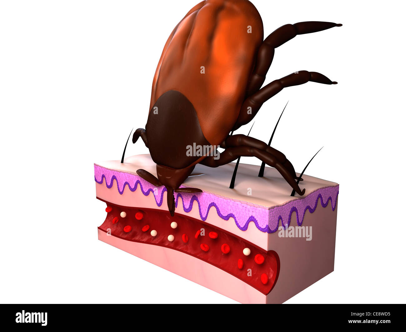 Tick Fütterung. Computer Grafik einen Tick (Überfamilie Ixodoidea) ernähren, zeigt einen Querschnitt durch die Haut. Stockfoto
