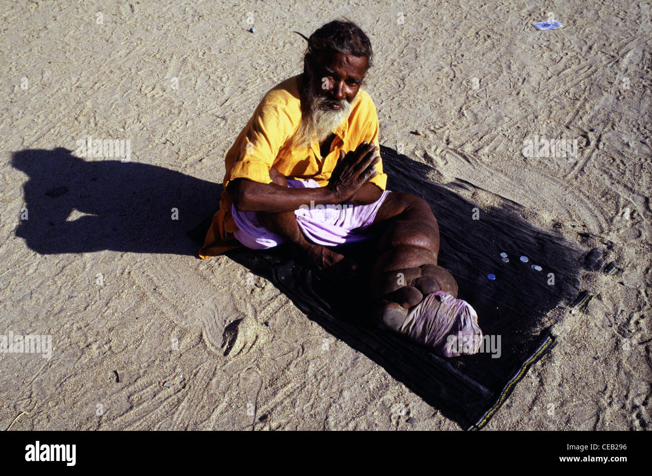 Bettelmönch mit boated Bein erkrankt Elephantiasis betteln in Süd-Indien Stockfoto