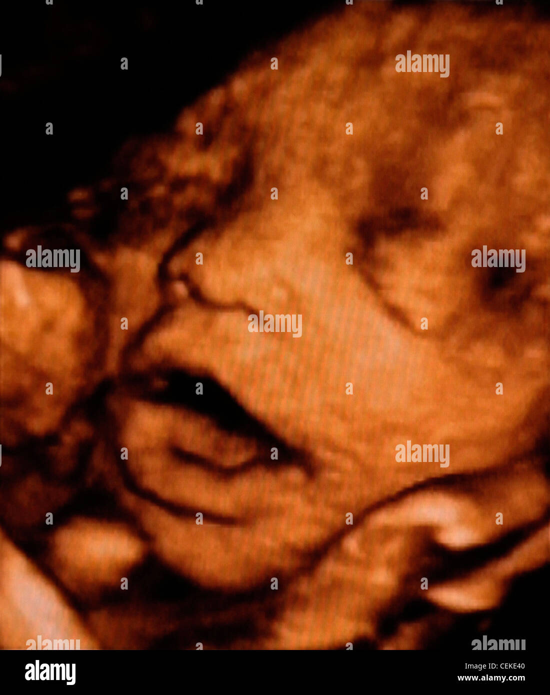 Ein 4D Ultraschallscan eines Fötus in der Gebärmutter Stockfoto
