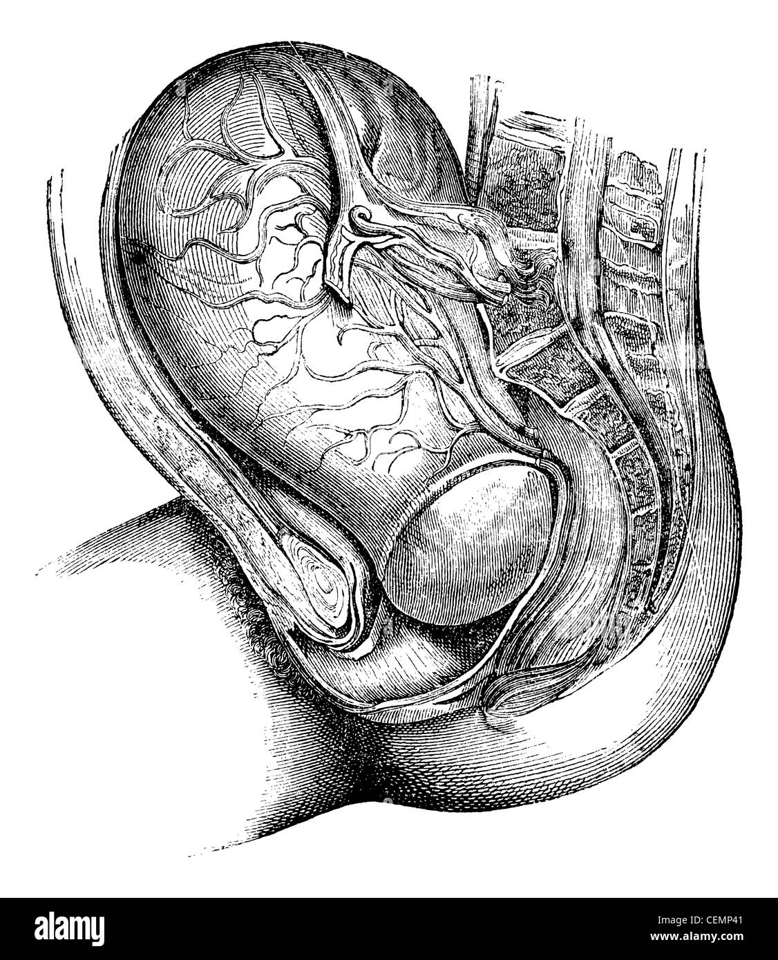 Fruchtblase, graviert Vintage Illustration. Magasin Pittoresque 1875. Stockfoto